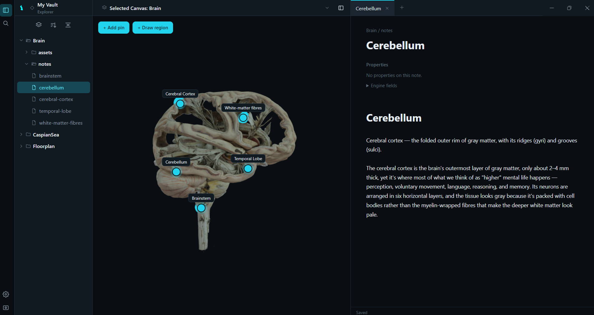 Notes pinned to a brain anatomy diagram in Caspian